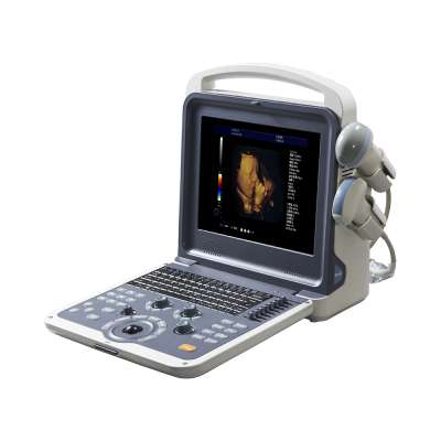 LTUB01 color doppler ultrasound portable