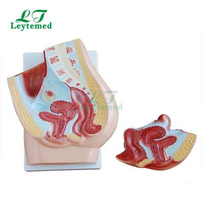 LTM327C 2 parts Human female pelvis anatomic model