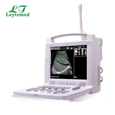 LTUB29 Portable vet ultrasound scanner / ultrasound machine for cow