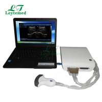 LTUB10 Full digital 3D image Ultrasound Box