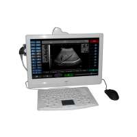 LTUB21 medical touch screen portable ultrasound machine price