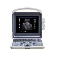 LTUB01 portable diagnostic ultrasound machine 4d price