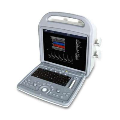 LTUB16 portable color doppler ultrasound scanner