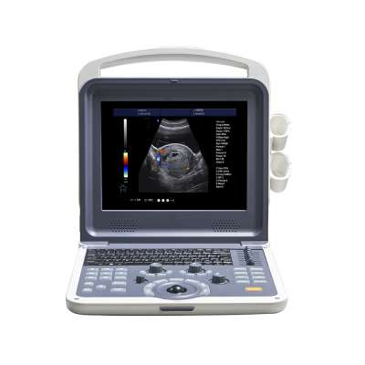 LTUB01 mini cheapest portable ultrasound machine 3d 4d