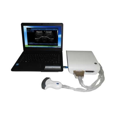 LTUB10 CE medical portable ultrasound equipment china