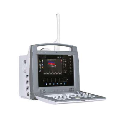 LTUB04 CE cheap portable cardiac ultrasound price